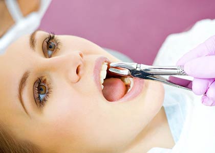 A dentist using extraction forceps on a patient's tooth