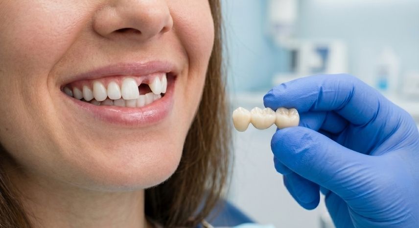 A patient with a gap where a tooth is missing, beside a dentist's gloved hand holding a three-unit dental bridge